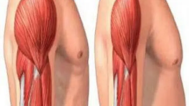 Kas hastalığı yürüme bozukluğunun en önemli nedeni 