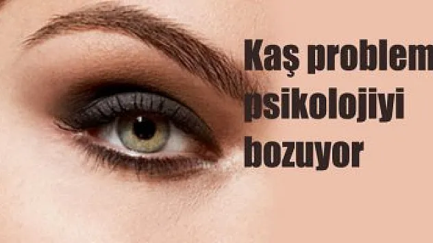Kaş problemi psikolojiyi bozuyor