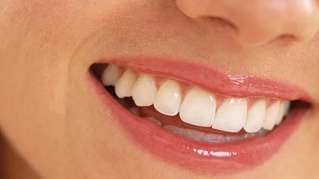 Gülüş tasarımın da 4 aşamaya dikkat