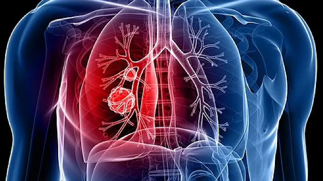 Akciğer kanserini yenen hastadan doktoruna teşekkür ziyareti