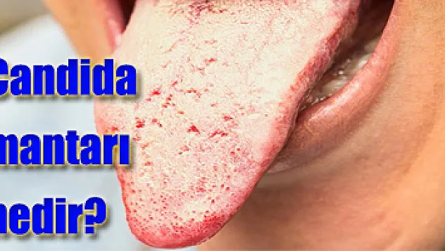 Candida mantarı nedir?