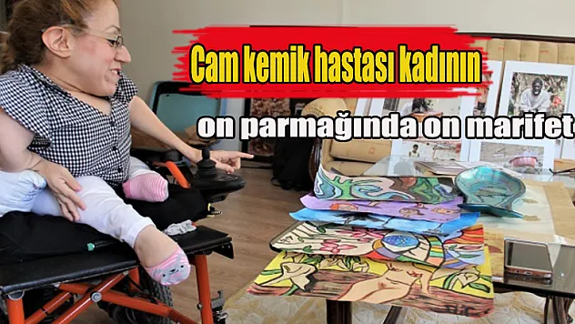 Cam kemik hastası kadının on parmağında on marifet