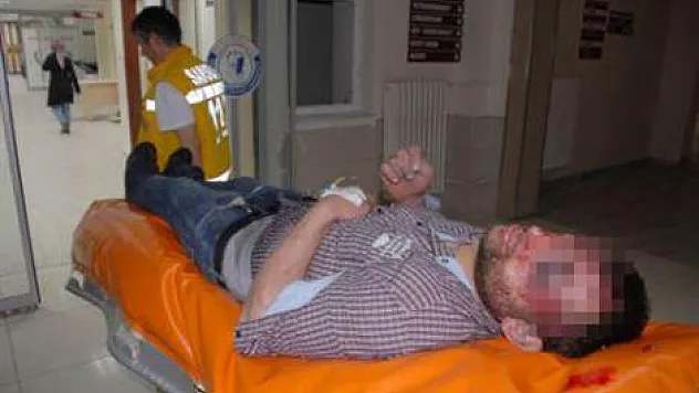 Kavgada kafasından vurulan genç öldü