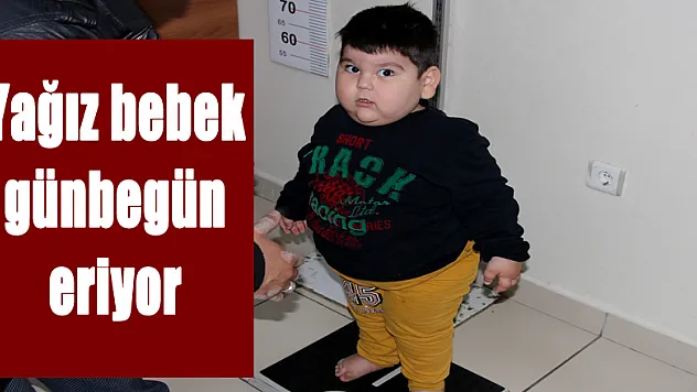 Yağız bebek günbegün eriyor