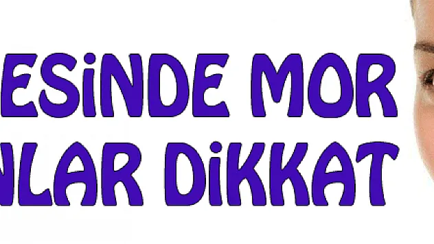 Göz çevresinde mor hale olanlar dikkat