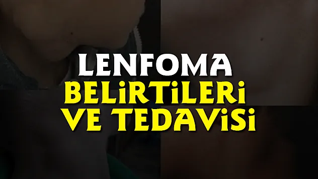 Lenfoma belirtileri ve tedavisi