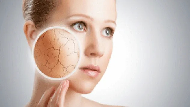 Kuru cilt probleminden kurtulmak mümkün