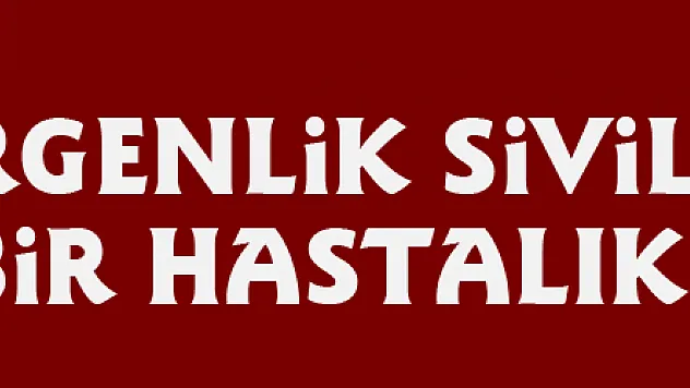 'Ergenlik sivilcelerinin bir hastalık değildir'