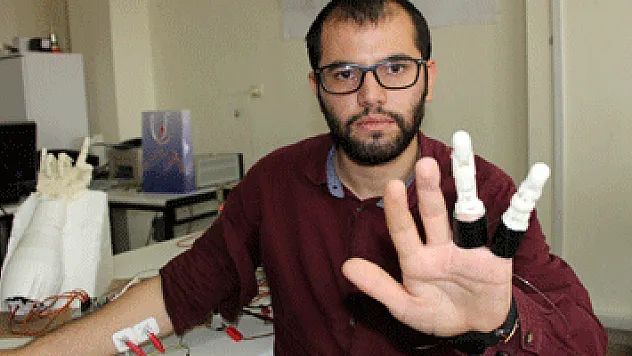 İki parmağını kaybeden mühendislik öğrencisi, kendine protez parmak yaptı