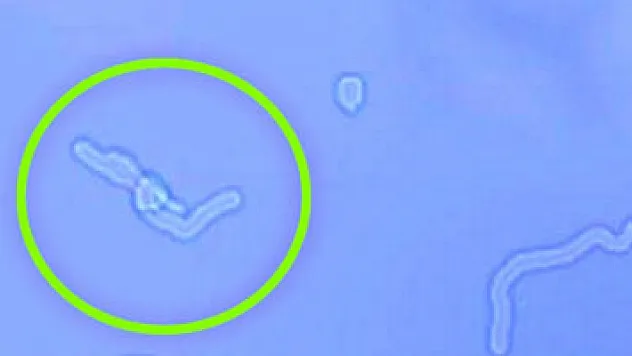 Gözünüzün önünde uçuşan sineklere dikkat