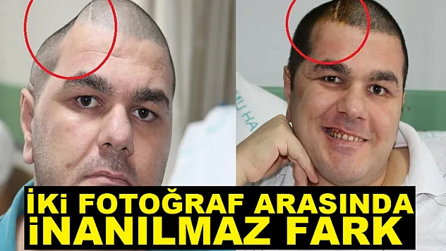 İki fotoğraf arasında inanılmaz fark