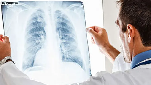 Akciğer kanserinde kemoterapi dönemi kapanıyor mu?