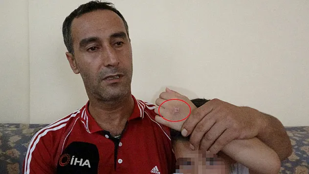 7 yaşındaki çocuğa ayrı yaşadığı annesi tarafından işkence iddiası 