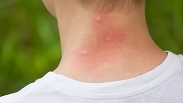 'Alerjinin sebebi eviniz olabilir'