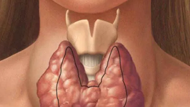 'Selenyum' guatrdan koruyor
