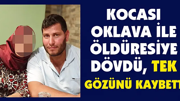Kocası oklava ile öldüresiye dövdü, tek gözünü kaybetti