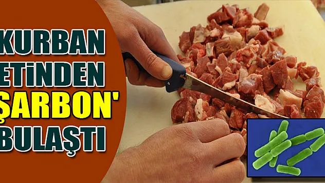 Samsun'da bir kişiye kurban etinden 'şarbon' bulaştı