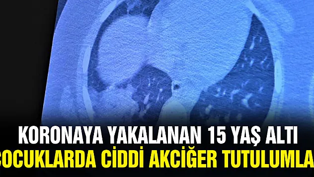 Koronaya yakalanan 15 yaş altı çocuklarda ciddi akciğer tutulumları