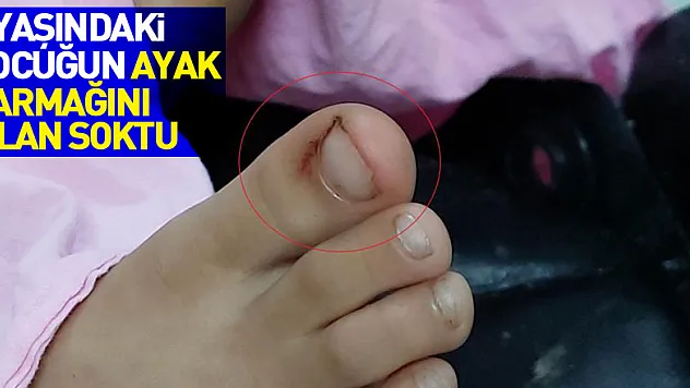 Ayak parmağını yılan sokan 7 yaşındaki çocuk hastanelik oldu