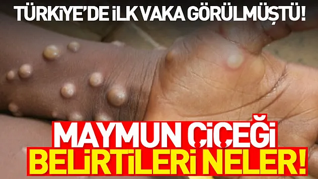 Maymun Çiçeği nedir? Maymun Çiceği belirtileri neler!