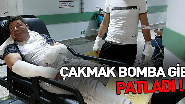 Çakmak bomba gibi patladı: 2 yaralı