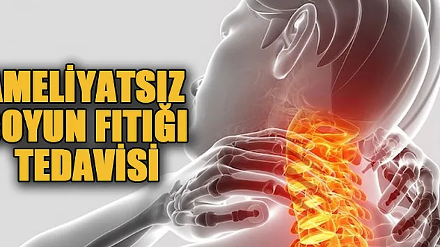 Ameliyatsız boyun fıtığı tedavisi mümkün