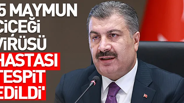 Bakan Koca: 'Şu ana kadar ülkemizde 5 maymun çiçeği virüsü hastası tespit edildi'