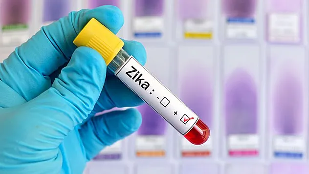 ZİKA VİRÜSÜNDE ÖLÜM ÇOK NADİR GÖRÜLÜYOR