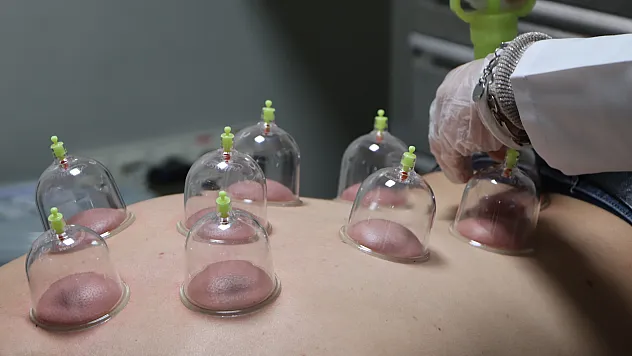 Uzmanından merdiven altı 'sülük' ve 'hacamat' uyarısı