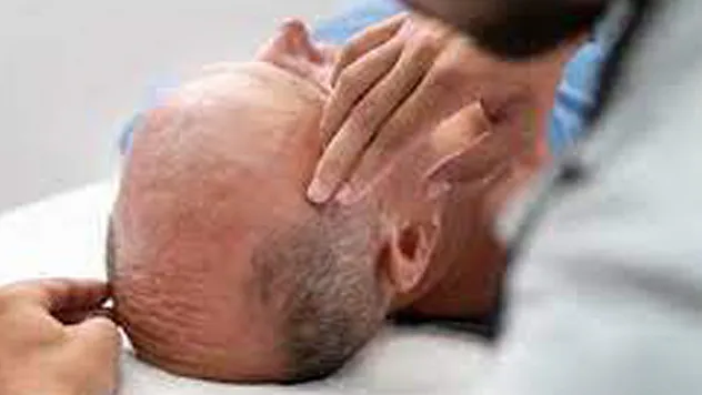 Saç ekimi merkezlerine yeni standart getirildi