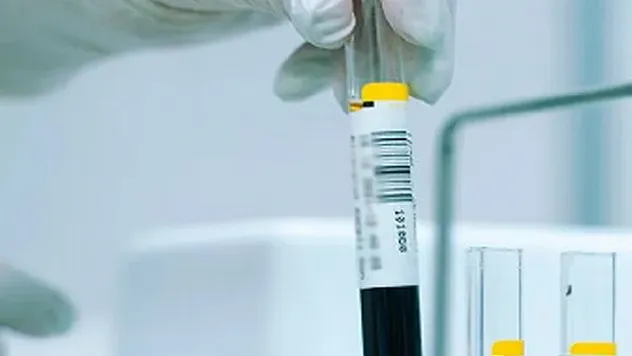 Türkiye'de nüfusun yüzde 2,1'i Akdeniz anemisi hastalığını taşıyor