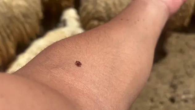 Derimizde kene fark edersek ne yapmalıyız ?