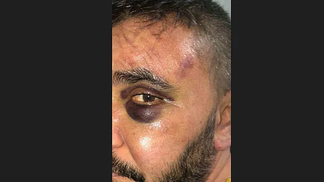 Dükkanında darp edildi, saldırganlar serbest