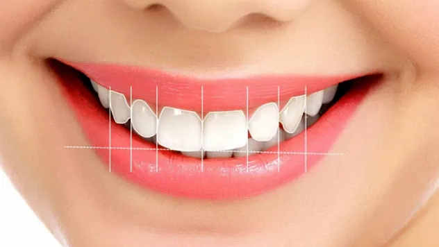 Estetik Bir Gülüş İçin Hangi Faktörler Dikkate Alınır?