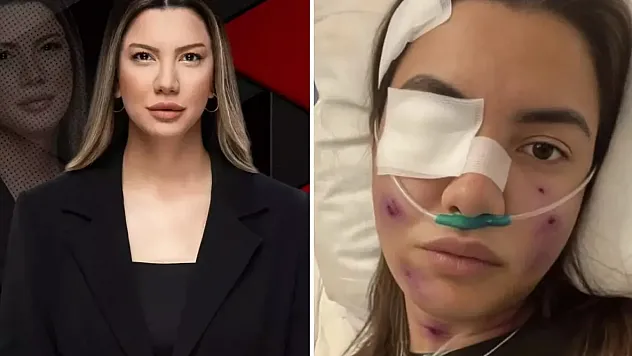 Fulya Öztürk Trafik Kazası mı Geçirdi? O Fotoğraf Sosyal Medyayı Salladı: Ünlü Gazeteciden Sert Açıklama!
