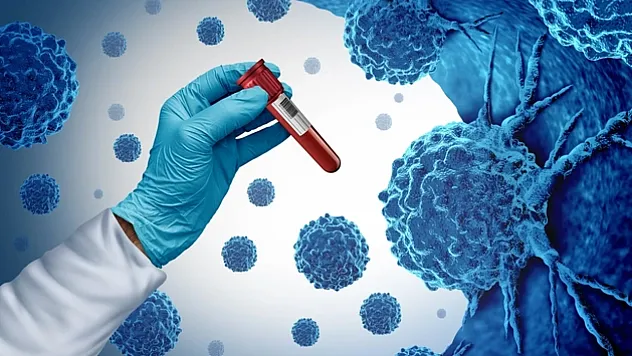 Kanserin Türleri ve Tedavi Yöntemleri: Erken Tanı Hayat Kurtarıyor