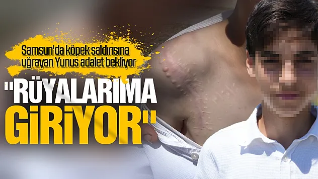 Köpek saldırısına uğrayan Yunus adalet bekliyor