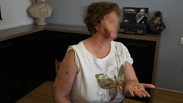 Kuşadası'nda ev kavgası kanlı bitti: Anne ve iki çocuğu bıçaklandı