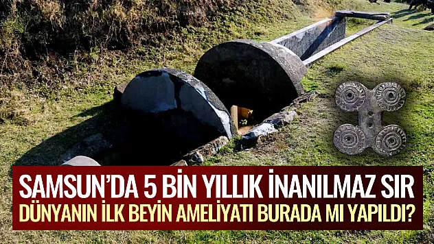 Samsun'da 5 bin yıllık inanılmaz sır: Dünyanın ilk beyin ameliyatı burada mı yapıldı?