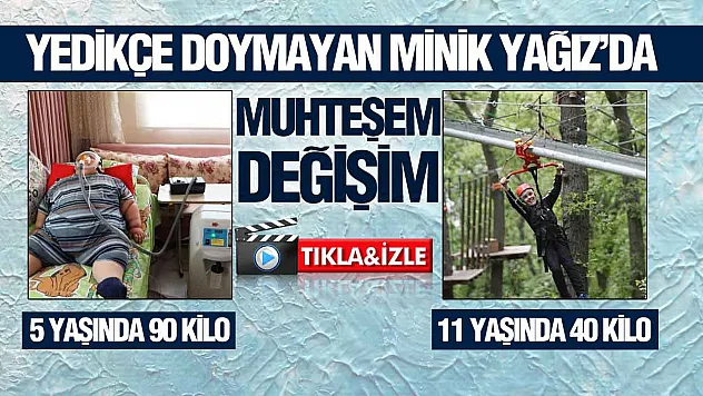 Samsun'da Yağız'ın inanılmaz değişimi, 5 yaşında 90 kiloydu, 11 yaşında 40 kilo