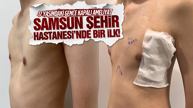 Samsun Şehir Hastanesi'nde bir ilk! 17 yaşındaki gencin göğüs kafesi kapalı ameliyatla düzeltildi