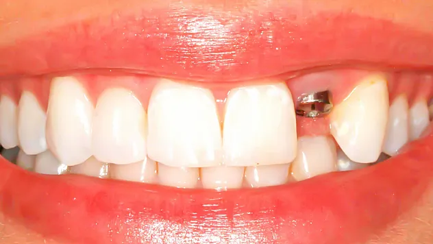 'Toplumda ağız sağlığı bilincinin artması gerekiyor'