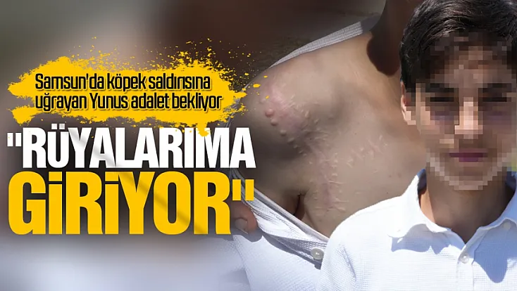 Köpek saldırısına uğrayan Yunus adalet bekliyor