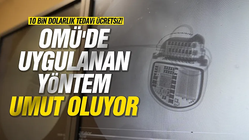 Geçmeyen Ağrılara Son Çare: Ağrı Pili