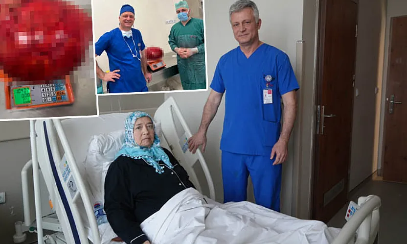 Görenler kilo aldı sandı, karnından 10,5 kiloluk dev kitle çıkarıldı