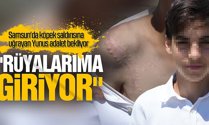 Köpek saldırısına uğrayan Yunus adalet bekliyor