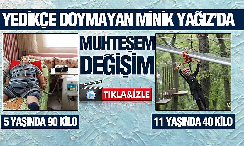 Samsun'da Yağız'ın inanılmaz değişimi, 5 yaşında 90 kiloydu, 11 yaşında 40 kilo