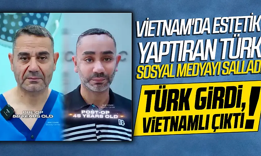 Vietnam'da yüz gençleştirme ameliyatı olan Türk vatandaşının son hali gündem oldu